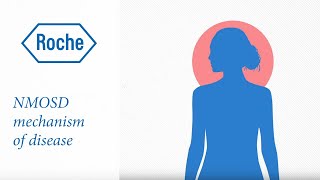 Neuromyelitis optica spectrum disorder  Mechanism of disease [upl. by Krucik545]