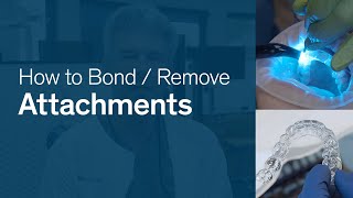 How To Bond amp Remove Attachments for Reveal® Clear Aligners [upl. by Alexine]