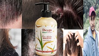 Deyga Rice Water Shampoo  Honest Review [upl. by Hughie413]