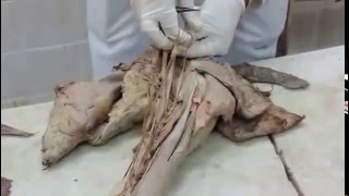 Mod 4  MS  Practical Anatomy  Dr Hazem Gamal  Upper Limb  Part 01 [upl. by Enerahs551]