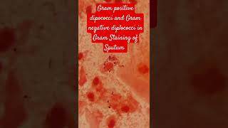 Gram positive dipococci and Gram Negative diplococci bacteria in Gram Staining of Sputum [upl. by Aneez698]