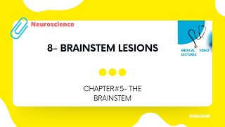 Brainstem lesions  CHAPTER5 THE BRAINSTEM [upl. by Eirameinna]