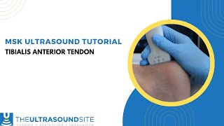 MSK ultrasound of the tibialis anterior tendon [upl. by Ahselat994]