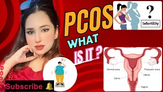 Important information about PCOS پی سی او اس کے بارے می اہم معلومات doctor pcos hirsutism [upl. by Yrol651]