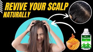 How to Detox Your Scalp Naturally [upl. by Erskine315]