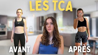 mon histoire avec les TCA [upl. by Enyamrahc]