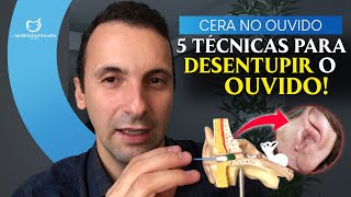 Como Desentupir o Ouvido e Quanta Cera Retirar 5 Técnicas diferentes e como deve limpar em casa [upl. by Hpesojnhoj]