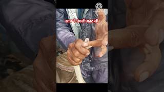 उंगली ही काट ली साप ने ytshorts shorts youtubeshorts shortvideo manojsnakesever [upl. by Cohberg]