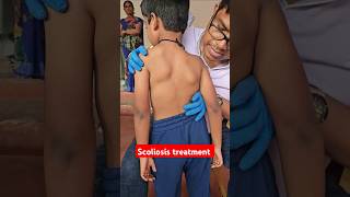 Scoliosis treatment drrajneeshkant worldfamouschiropractor [upl. by Retsof]