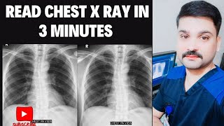 How To Read A Chest Xray in Urdu [upl. by Schwenk257]