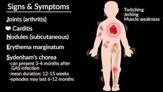 Acute Rheumatic Fever by E Rusingiza  OPENPediatrics [upl. by Araed168]