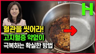 매일 이것만 하면 고지혈증 약 없이 사라집니다 건강한 혈관 만드는 가장 간단한 방법 [upl. by Halpern238]