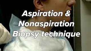 Aspiration amp Nonaspiration Zajdela technique  Biopsy Fine Needle Neck Mass [upl. by Merrel336]