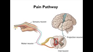 Electrotherapy Lecture 2 How do we perceive and treat pain  acute and chronic types [upl. by Abercromby393]