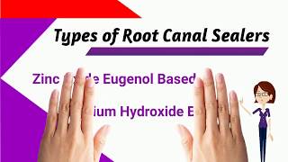 Types of Root Canal Sealers [upl. by Nylodnew]