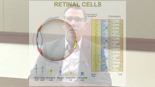 Positive Results from Randomized Controlled Trials of MCO10 Gene Therapy for RP amp Stargardt [upl. by Akila962]