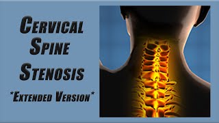 Best Exercises for Stenosis in the Cervical Spine  Slower Pace and More Reps [upl. by Haim]