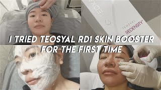 BEAUTYVLOG I TRIED THE TEOSYAL RD1 SKIN BOOSTER FOR THE FIRST TIME AT MODE MEDICAL CLINIC AND [upl. by Elyag]