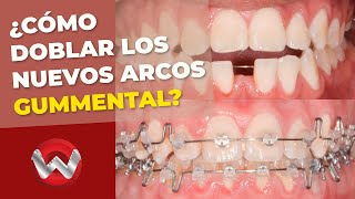 Cómo doblar los nuevos arcos Gummetal para un tratamiento exitoso de clase III [upl. by Adiesirb727]