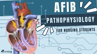 AFIB Atrial Fibrillation Pathophysiology Cardiac Nursing [upl. by Dira]