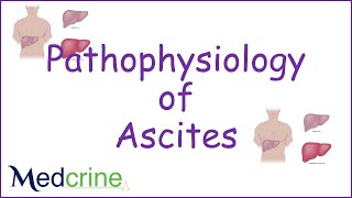 pathophysiology of ascites [upl. by Candida235]