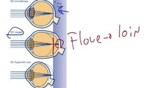 Myopie presbytie et hypermétropie [upl. by Nesbitt225]