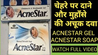 ACNESTAR GEL AND ACNESTAR SOAP REVIEW II ACNE PIMPLE CREAM AND ACNE PIMPLE SOAP [upl. by Risley]