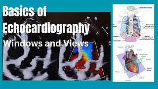 Basics of Echocardiography  Windows and Views [upl. by Ike]