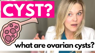 OVARIAN CYSTS What Causes Ovarian Cysts [upl. by Idette]