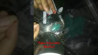 How to test malaria through malarial kit💉malarialtestprocedurebloodtest medicallife [upl. by Ietta]