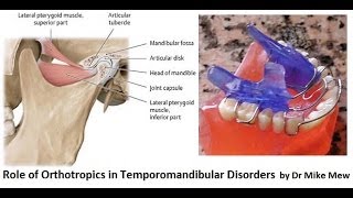 Orthotropics Treatment of Temporomandibular Joint Disorders by Dr Mike Mew [upl. by Etnoek]