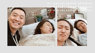 My Gallbladder Removal Experience [upl. by Nedle]