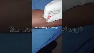 Intravenous cannulation procedure medico virlshort viral shotrs [upl. by Tatiania]