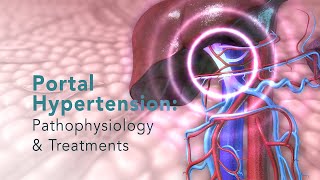 PORTAL HYPERTENSION Pathophysiology and Common Treatments [upl. by Eirdua713]