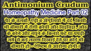 Antimonium Crudum  Homeopathic Medicine  Part 02 bydrncghosh [upl. by Nobe]