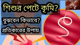 শিশুদের কৃমির লক্ষণ ও চিকিৎসা  How to treat worm infection in children [upl. by Nai]