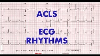 ACLS  ECG rhythm recognition amp management Part 1 [upl. by Maletta]