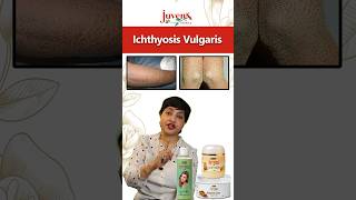 Ichthyosis Vulgaris skincare healthyskin selfcare ichthyosis skincaretips skin deadskincells [upl. by Yhpos951]