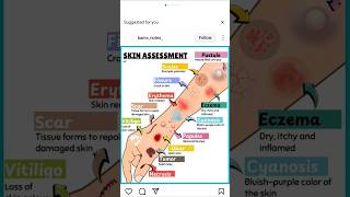 Skin assessment in different parts viralshorts medical shortbiology [upl. by Briny]