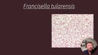 MLS Francisella tularensis Case Study [upl. by Aizitel]