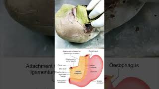 Attachment of lesser omentum on to the liver shorts anatomy biology [upl. by Akitan]