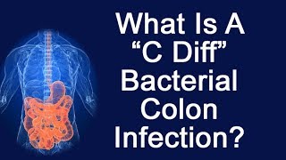 What Is A quotC Diffquot Bacterial Colon Infection [upl. by Ednutabab]