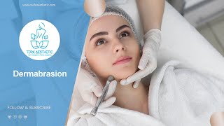 Dermabrasion in Turkey 45 Minutes  Turk Aesthetic [upl. by Leahcimaj]