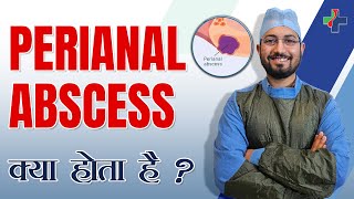 Perianal Abscess  Causes And Treatment Of Perianal Abscess  Dr Anshul Shah [upl. by Sonstrom]