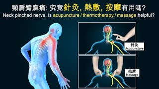 頸肩臂麻痛 究竟針灸 熱敷 按摩有用嗎  Neck pinched nerve is acupuncturethermotherapymassage helpful  N05 [upl. by Kellda222]