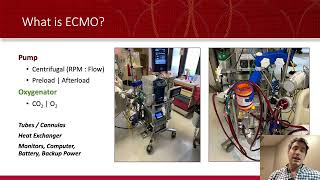 ECMO A Simple Approach to the Equipment [upl. by Yajiv]