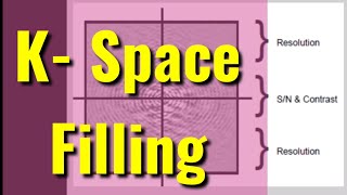 How to understand of K  Space Filling in MRI Physic Part 4 [upl. by Gillett]