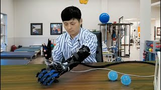 Robotic Hand After Stroke Rehabilitation Exercise [upl. by Loeb]