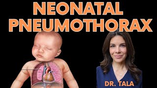 How do you DIAGNOSE and TREAT a newborns PNEUMOTHORAX [upl. by Oironoh]