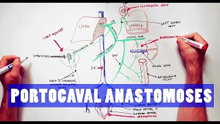 Portocaval Anastomoses  ANATOMY Tutorial [upl. by Aznofla22]